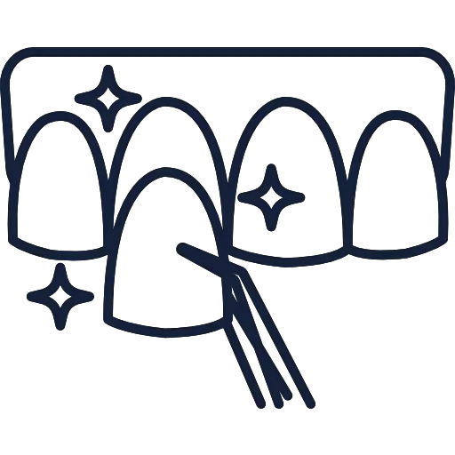 Veneers Hollywood smile