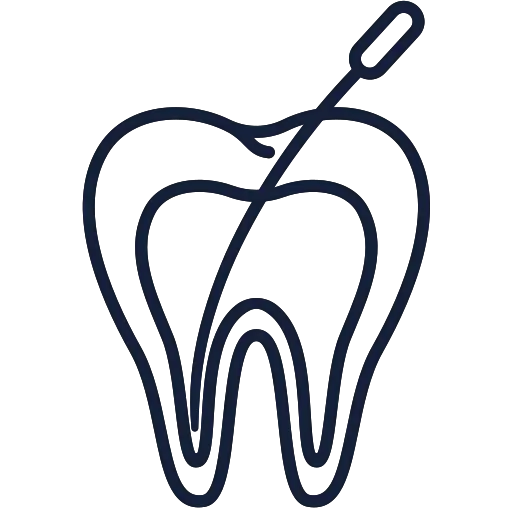 Filling and Root canal